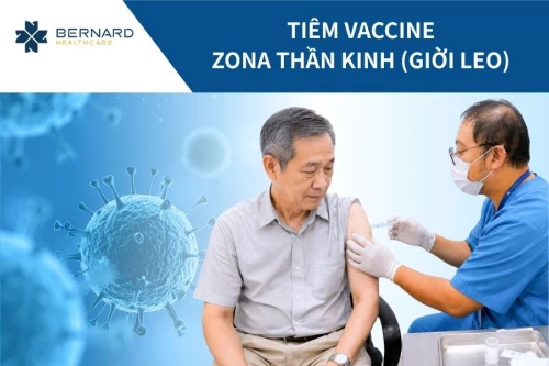 Vaccine Zona thần kinh (Giời leo)